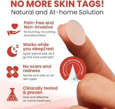 Derma Smooth Skin Tag Removal Patch Kashio Fast Acting Painless Skin Tag and Mole Remover Patch Natural Formula for Clear Smooth Skin Safe for All Skin Types