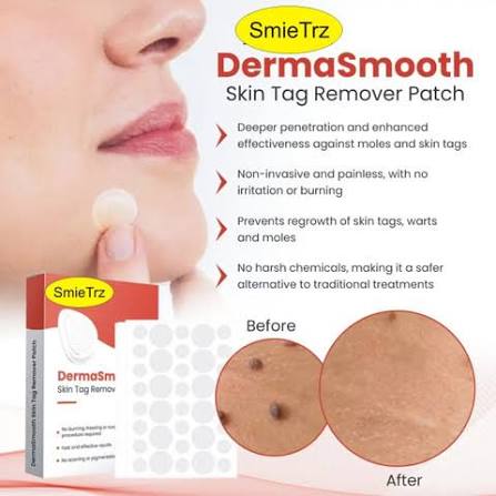 Derma Smooth Skin Tag Removal Patch Kashio Fast Acting Painless Skin Tag and Mole Remover Patch Natural Formula for Clear Smooth Skin Safe for All Skin Types